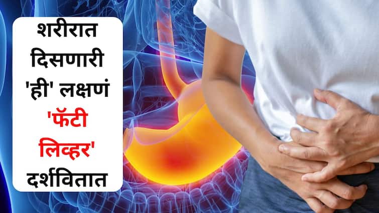 Health lifestyle marathi news know symptoms in body indicate fatty liver at higher risk How to avoid? find out Health : केवळ अल्कोहोल सेवन करणारेच नाही, तर 'यांनाही' फॅटी लिव्हरचा धोका! लक्षणं काय? कसे टाळाल?