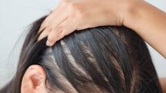 સતત વાળ ખરતા હોય અને વજનમાં ઘટાડો થાય તો આ બીમારી હોઈ શકે