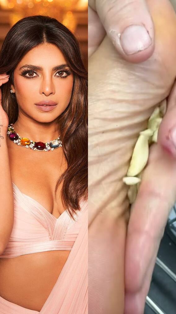 প্রিয়ঙ্কার মত রসুন ঘষতে পারেন পায়ের তলায়, কী উপকার জানেন?