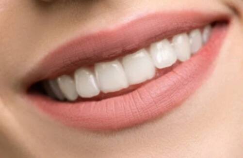 எலுமிச்சை சாறுடன் உப்பு சேர்த்து பற்களில் தேய்த்து வந்தால் மஞ்சள் கறைகள் நீங்கலாம்.