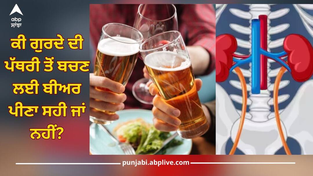 Health News: ਕੀ ਗੁਰਦੇ ਦੀ ਪੱਥਰੀ ਤੋਂ ਬਚਣ ਲਈ ਬੀਅਰ ਪੀਣਾ ਸਹੀ ਜਾਂ ਨਹੀਂ? ਜਾਣੋ ਕੀ ਕਹਿੰਦੇ ਮਾਹਿਰ Is it right to drink beer to avoid kidney stones? Find out what experts say Health News: ਕੀ ਗੁਰਦੇ ਦੀ ਪੱਥਰੀ ਤੋਂ ਬਚਣ ਲਈ ਬੀਅਰ ਪੀਣਾ ਸਹੀ ਜਾਂ ਨਹੀਂ? ਜਾਣੋ ਕੀ ਕਹਿੰਦੇ ਮਾਹਿਰ