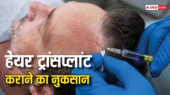 हेयर ट्रांसप्लांट से पागल हो सकता है इंसान? जानें किन चीजों का होता है खतरा