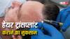 Hair Transplant: हेयर ट्रांसप्लांट से पागल हो सकता है इंसान? जानें किन चीजों का होता है खतरा