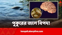 মস্তিষ্ক খেকো অ্যামিবার সংক্রমণ, পুকুরে স্নান করে চরম পরিণতি কিশোরের