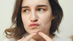 Skin Care Tips: முகப்பரு நீங்க சூப்பர் ஃபேஸ் மாஸ்க் இருக்கு; இதோ எப்படி செய்வது?