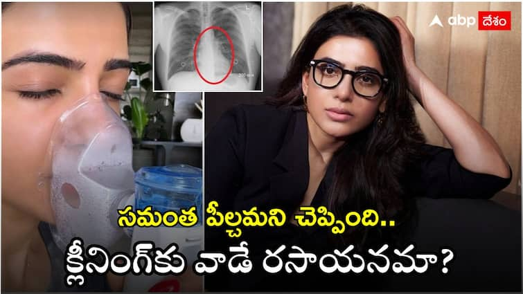 Truth Behind Samantha's Health Tip in Instagram Expert Warns of Dangers Samantha: సమంత హెల్త్ టిప్ ప్రాణాలు తీస్తుందా? హైడ్రోజన్ పెరాక్సైడ్ అంత డేంజరా.. నిపుణులు ఏమంటున్నారు?