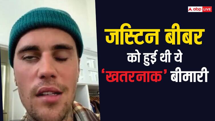 Justin bieber disease ramsay  hunt syndrome what  is it and  symtoms Ramsay Hunt Syndrome: जस्टिन बीबर को हुई थी ये अजीब बीमारी, पूरे चेहरे पर मार गया था लकवा