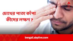 ডান বা বাম চোখের পাতা কাঁপছে ? অশুভ ইঙ্গিত না অন্য কিছু ?