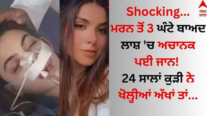 Weird News: ਅਸੀ ਆਪਣੇ ਆਸ-ਪਾਸ ਅਕਸਰ ਕਈ ਅਜਿਹੇ ਕਿੱਸੇ ਸੁਣਦੇ ਹਾਂ, ਜਿਸ ਉੱਪਰ ਵਿਸ਼ਵਾਸ਼ ਕਰਨਾ ਸਾਡੇ ਲਈ ਵੀ ਮੁਸ਼ਕਿਲ ਹੋ ਜਾਂਦਾ ਹੈ। ਪਰ ਅਜਿਹੀਆਂ ਕਈ ਘਟਨਾਵਾਂ ਹੁੰਦੀਆਂ ਹਨ, ਜੋ ਸਾਨੂੰ ਸੋਚਣ ਤੇ ਮਜ਼ਬੂਰ ਕਰ ਦਿੰਦੀਆਂ ਹਨ।