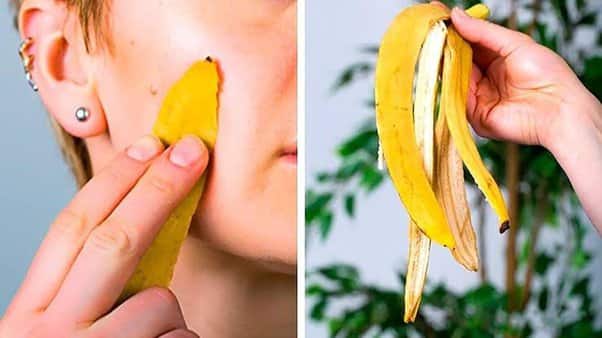 Apply the inside of the banana peel under the eyes, then wash it with clean water after 10 minutes. This will remove dark circles.