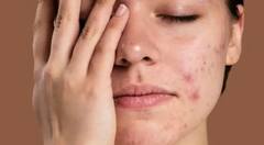 ચહેરા પરના દાગ દૂર કરવા માટે અપનાવો આ ઘરેલું ઉપાય, થશે ફાયદો