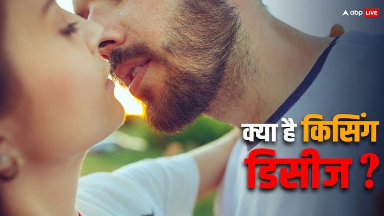 what is kissing Disease know about its symptoms and effects Kissing Disease: क्या है किसिंग डिजीज जिसके चलते ब्रिटेन की छात्रा को अस्पताल में होना पड़ा भर्ती, जानें इसके लक्षण