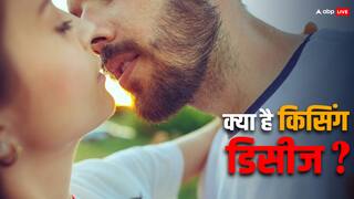 Kissing Disease: क्या है किसिंग डिजीज जिसके चलते ब्रिटेन की छात्रा को अस्पताल में होना पड़ा भर्ती, जानें इसके लक्षण