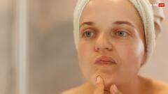 Pimples Problem: आपके चेहरे पर भी मेकअप के बाद हो जाते हैं पिंपल्स, तो करें ये आसान काम