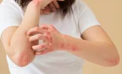 Monsoon Skincare: ਮਾਨਸੂਨ ਦੌਰਾਨ ਸਕਿਨ ਨੂੰ ਫੰਗਲ ਇਨਫੈਕਸ਼ਨ ਸਣੇ ਘੇਰਦੀਆਂ ਇਹ ਬਿਮਾਰੀਆਂ, ਇੰਝ ਕਰੋ ਬਚਾਅ