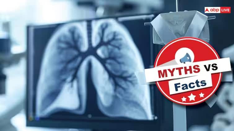 Does smoking alone cause lung cancer, a disease that does not occur at a young age, know what is the myth and fact Myth vs Facts: શું માત્ર સ્મોકિંગથી થાય છે લંગ કેન્સર, નાની વયે નથી થતી  આ બીમારી, જાણો શું છે  હકીકત