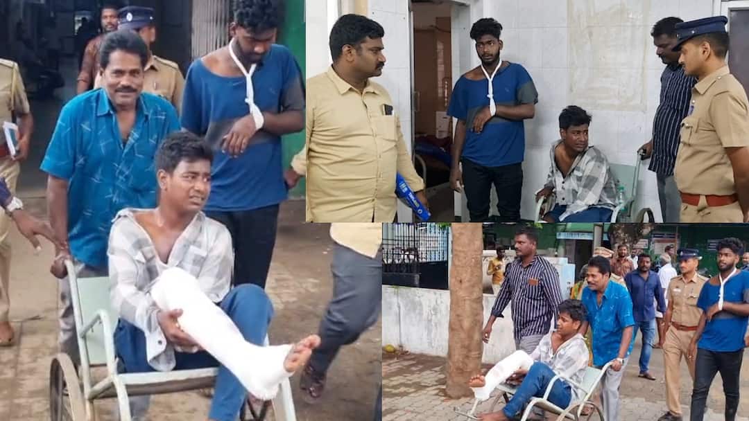 Kanchipuram, a rowdy broke his leg after attacking a youth Kanchipuram Police are Investigation on this issue tnn அய்யோ வலிக்குதே... கதறி துடித்த குட்டி ரவுடி.. மாவு கட்டு போட்டு விட்ட போலீஸ்.. நடந்தது என்ன?
