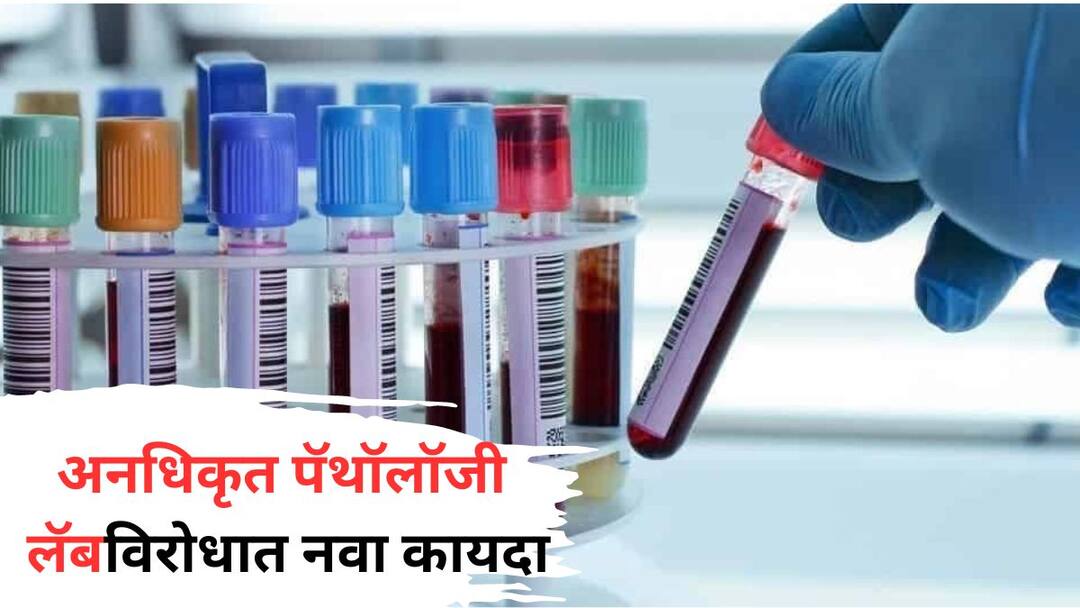 Maharashtra News: अनधिकृत पॅथॉलॉजी लॅबविरोधात लवकरच कायदा; विनानोंदणी लॅबविरोधात शिक्षेची तरतूद Law to monitor Unauthorized Pathology Labs Soon provision of punishment Minister Uday Samant information Maharashtra Monsoon Session Marathi News Maharashtra News: अनधिकृत पॅथॉलॉजी लॅबविरोधात लवकरच कायदा; विनानोंदणी लॅबविरोधात शिक्षेची तरतूद