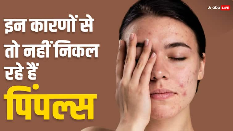 Persistent Pimples Not Responding to Home Remedies It Could Be Hormonal चेहरे पर निकल रहे हैं लंबे समय से दाने, घरेलू उपाय से नहीं हो रहे ठीक तो कहीं ये हार्मोनल प्रॉब्लम तो नहीं?