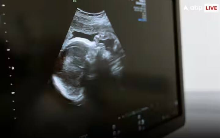 ਜਾਣਕਾਰੀ ਮੁਤਾਬਕ ਇਨ੍ਹਾਂ ਸਾਰੀਆਂ ਔਰਤਾਂ ਨੂੰ ਦੋ ਵਾਰ ਪਲੇਸਬੋ ਜਾਂ OXO-001 ਦਵਾਈ ਦਿੱਤੀ ਗਈ ਸੀ। ਮਾਹਵਾਰੀ ਚੱਕਰ ਦੌਰਾਨ ਭਰੂਣ ਦੇ ਇਮਪਲਾਂਟੇਸ਼ਨ ਤੋਂ ਪਹਿਲਾਂ ਦਿੱਤੀ ਗਈ ਅਤੇ ਪੰਜ ਹਫ਼ਤਿਆਂ ਬਾਅਦ ਦਵਾਈ ਦੁਬਾਰਾ ਦਿੱਤੀ ਗਈ ਸੀ।