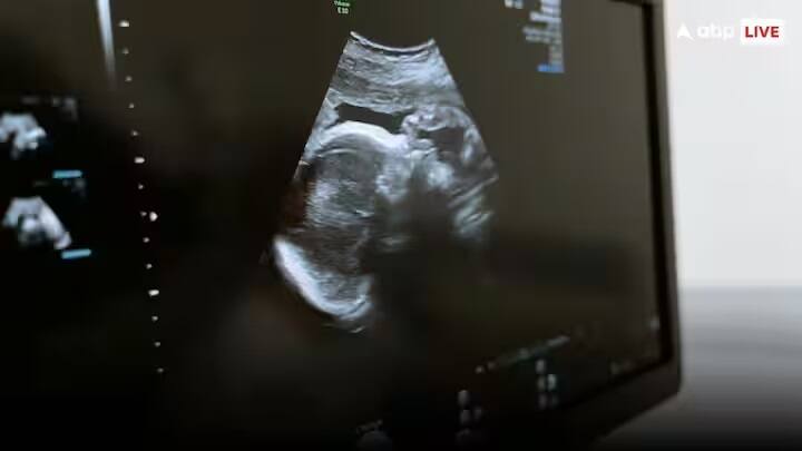 આ દવા એવા દંપતીઓ માટે જ ફાયદાકારક રહેશે જેઓ IVF ટ્રીટમેન્ટ દ્વારા ગર્ભાવસ્થાની યોજના બનાવી રહ્યા છે. આ દવાનું નામ OXO-001 છે, જેની પ્રારંભિક ટ્રાયલ ચાલી રહી છે.