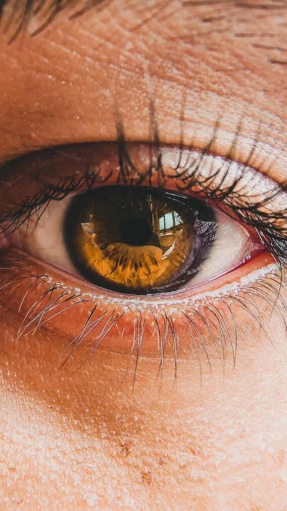 వర్షాకాలంలో కళ్ల కలకలు- ఈ జాగ్రత్తలు తప్పనిసరి!