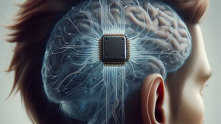 Neuralink Second Human Implant Elon Musk Brain Chip Expansion Musk's Neuralink Prepares For Second Human Brain Chip Implant 'Within Next Week'