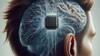 Musk's Neuralink Prepares For Second Human Brain Chip Implant 'Within Next Week'