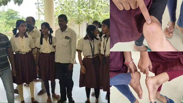 rats bite girl students in ramayampeta social welfare residential school in medak district Medak News: పాఠశాలలో ఎలుకల స్వైర విహారం -  విద్యార్థినులకు గాయాలు, మెదక్ జిల్లాలో ఘటన