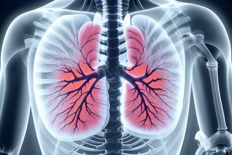 lung cancer non smokers risk india સિગારેટ ન પીનારાઓને પણ ફેફસાંના કેન્સરનું જોખમ, ભારતમાં આવા દર્દીઓની સરેરાશ ઉંમર ઓછી