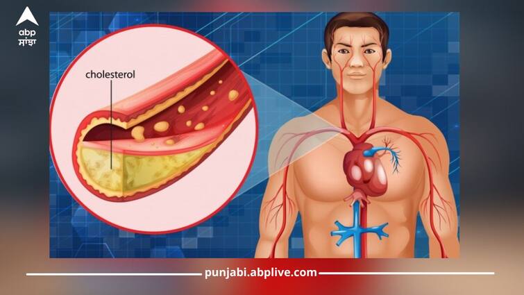 simple ways to naturally lower cholesterol and keep your veins healthy news Cholesterol: ਸਰੀਰ 'ਚੋਂ ਇੰਝ ਕੱਢੋ ਜੰਮਾ ਹੋਏ ਕੋਲੈਸਟ੍ਰਾਲ ਨੂੰ, ਬਸ ਕਰੋ ਇਹ ਕੰਮ...ਸਰੀਰ ਹੋ ਜਾਵੇਗਾ ਤੰਦਰੁਸਤ