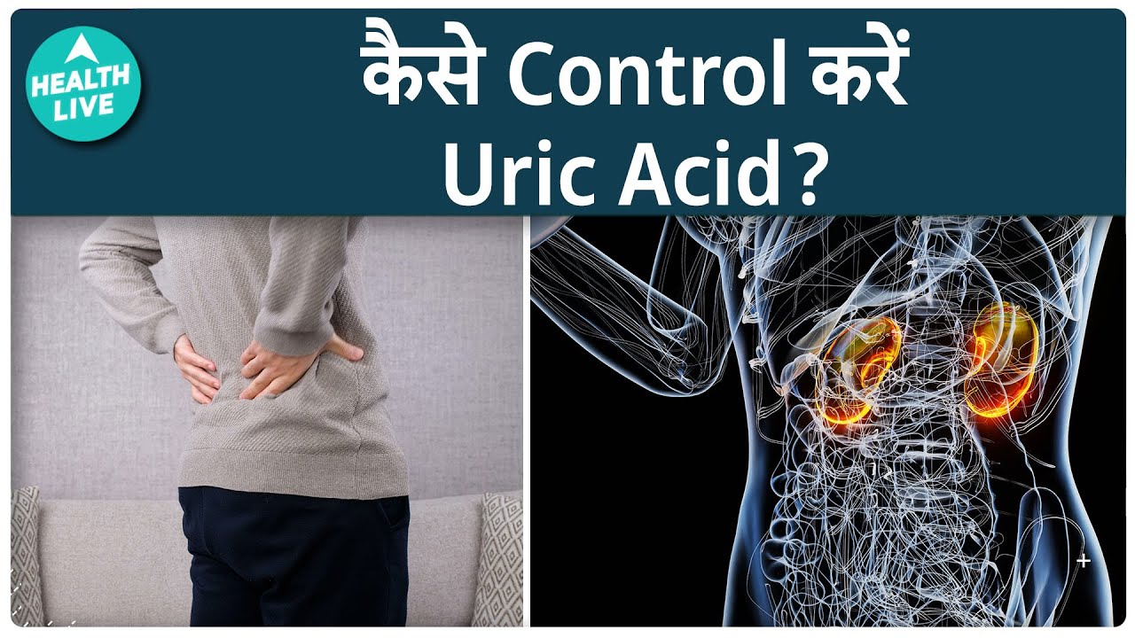 Uric Acid Symptoms & Treatment: Tips to control Uric Acid in the body | ABP Health Live