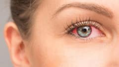 ਬੱਚੇ ਵੀ ਹੋ ਰਹੇ ਹਨ ਅੱਖਾਂ ਦੀ ਇਸ ਬਿਮਾਰੀ ਦਾ ਸ਼ਿਕਾਰ, ਗੌਰ ਨਾ ਕਰਨ 'ਤੇ ਜਾ ਸਕਦੀ ਹੈ ਰੋਸ਼ਨੀ...