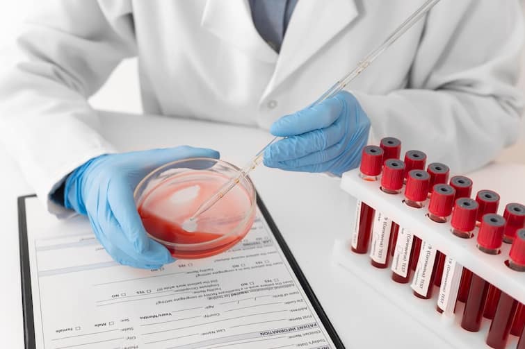 Why shouldn not  young men and women with the same blood group get married, know the expert's opinion આ સમાન બ્લડ ગ્રૂપ ધરાવતા યુવક-યુવતીએ કેમ  ન કરવા જોઇએ લગ્ન, જાણો એક્સ્પર્ટનો મત