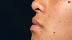 Beauty Tips: જો તમારા પણ ડાર્ક સર્કલ દેખાય છે, તો આરીતે તેનાથી છુટકારો મેળવો..