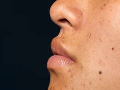 Beauty Tips: ਡਾਰਕ ਸਪਾਟਸ ਤੋਂ ਛੁਟਕਾਰਾ ਪਾਉਣ ਦਾ ਆਸਾਨ ਤਰੀਕਾ, ਇਸ ਤਰ੍ਹਾਂ ਕਰੋ ਅਪਲਾਈ