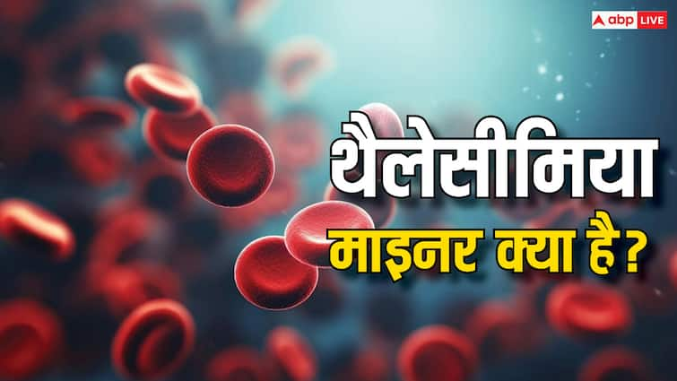 What is thalassemia minor? How does it affect young children?