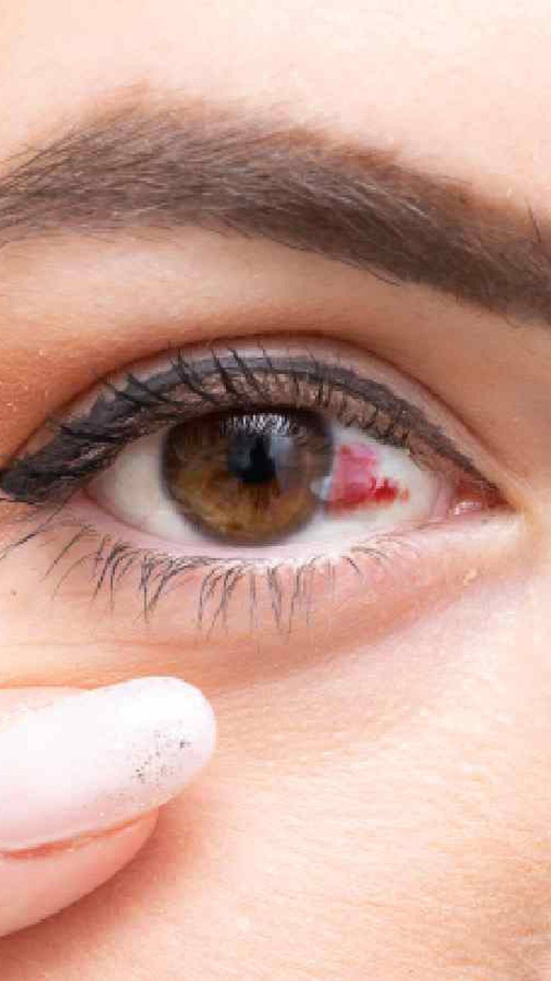 इस बीमारी का