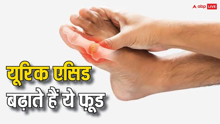 health tips foods to avoid in uric acid problems know what to do Uric Acid Food: तेजी से बढ़ रहा यूरिक एसिड? कहीं आप भी तो नहीं खा रहें ये चीजें