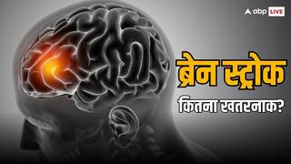 Brain Stroke: कितनी तरह का होता है ब्रेन स्ट्रोक? न्यूरोलॉजिस्ट से जानें सभी के बारे में