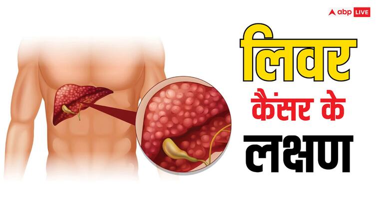 common symptoms of stage 4 liver cancer include read full article in hindi लिवर में कैंसर फैलने के बाद इंसान को मिलते हैं ये संकेत, नहीं पहचाना तो हो सकती है मौत