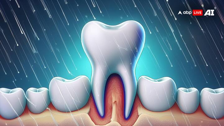 Tooth sensitivity strikes when the protective layer of your teeth, called enamel, wears down, or when gums recede, exposing the underlying dentin. Dentin is like a superhighway to your tooth’s nerve center, with tiny tubes that send hot, cold, sweet, or acidic sensations straight to the nerves, causing sharp pain. During the monsoon, the drop in temperature makes the teeth more sensitive. And let's be honest, the rainy season cravings for hot beverages and spicy, tangy foods don’t help either—they can trigger sensitivity in already compromised teeth. (Image Source: ABP Live AI)
