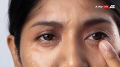 5 Signs Of Ageing Around The Eyes