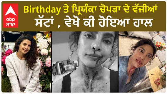 Birthday ਤੇ ਪ੍ਰਿਯੰਕਾ ਚੋਪੜਾ ਦੇ ਵੱਜੀਆਂ ਸੱਟਾਂ , ਵੇਖੋ ਕੀ ਹੋਇਆ ਹਾਲ
