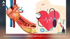 Health News: ਕੋਲੈਸਟ੍ਰਾਲ ਦੀ ਸਮੱਸਿਆ ਤੋਂ ਹੋ ਪਰੇਸ਼ਾਨ...ਸਹੀ ਕਰਨ ਲਈ ਵਰਤੋਂ ਇਹ ਵਾਲੇ ਕੁਦਰਤੀ ਤਰੀਕੇ