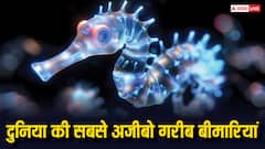 दुनिया की ये पांच बीमारियां हैं सबसे अजीब, सुनकर नहीं होता है यकीन