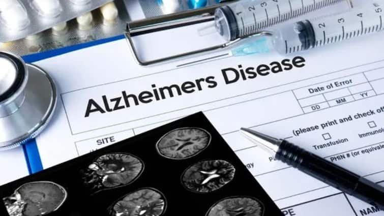 the hope of a vaccine for this brain-related disease Harvard scientists are preparing Alzheimers Disease: ਦਿਮਾਗ ਨਾਲ ਜੁੜੀ ਇਸ ਬਿਮਾਰੀ ਦੀ ਵੈਕਸੀਨ ਦੀ ਆਸ ਬੱਝੀ,  Harvard ਦੇ ਵਿਗਿਆਨੀ ਕਰ ਰਹੇ ਹਨ