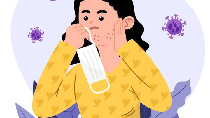 फ्लू जिसे इन्फ्लूएंजा भी कहा जाता है. उसकी वजह से नाक, गले और फेफड़ों में इंफेक्शन होने लगता है. इसके कारण सांस की नली में भी इंफेक्शन होने लगता है.यह सबकुछ फ्लू वायरस के कारण होता है. इन्फ्लूएंजा को आम तौर पर फ्लू कहा जाता है, लेकिन यह पेट के 'फ्लू' वायरस से अलग है जो दस्त और उल्टी का कारण बनता है.