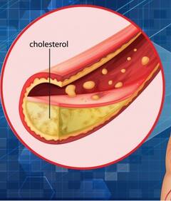 Health News: ਕੋਲੈਸਟ੍ਰਾਲ ਦੀ ਸਮੱਸਿਆ ਤੋਂ ਹੋ ਪਰੇਸ਼ਾਨ...ਸਹੀ ਕਰਨ ਲਈ ਵਰਤੋਂ ਇਹ ਵਾਲੇ ਕੁਦਰਤੀ ਤਰੀਕੇ