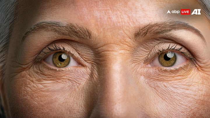 Ageing around the eyes manifests as a tired look or saggy and droopy eyelids, with wrinkles being common. The periorbital area also has changes coming together giving the person an aged or tired look.